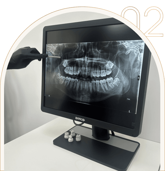 Chirurgia stomatologiczna w Dental Love Chirurgia stomatologiczna w Dental Love