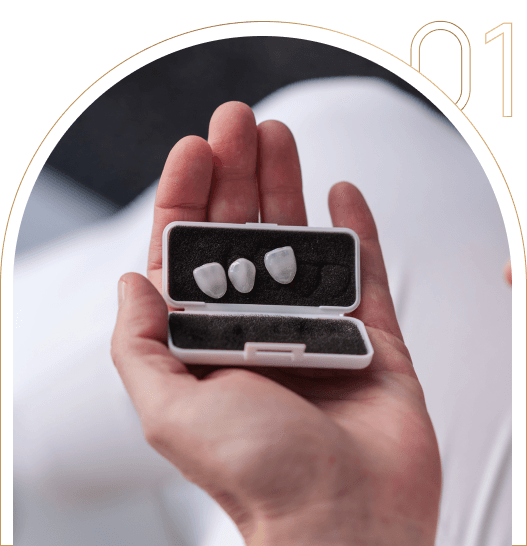 Czym są licówki zębowe? Eleganckie licówi zębowe Tychy