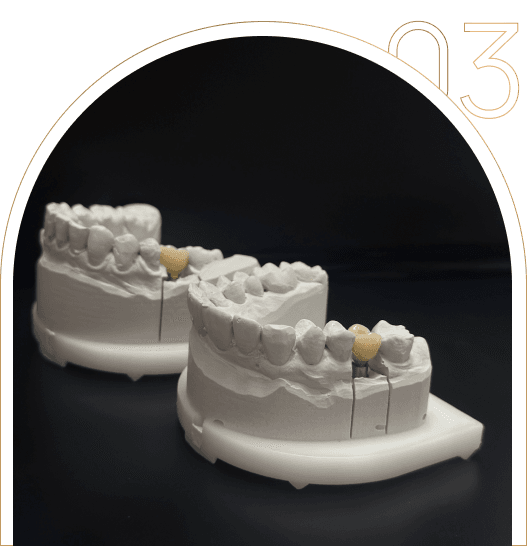 Dlaczego warto skorzystać z usług protetycznych Dlaczego warto skorzystać z usług protetycznych