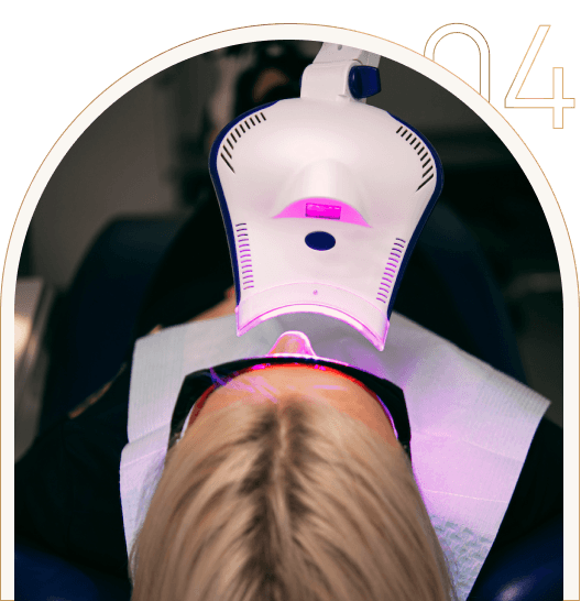 Gabinetowe wybielanie zębów Gabinetowe wybielanie zębów Tychy