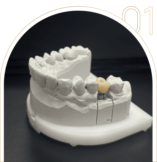 Implantologia w Tychach Leczenie implantologiczne w Tychach