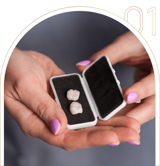 Gotowe korony zębowe Gotowe korony zębowe wykonane w DentalLove w Tychach