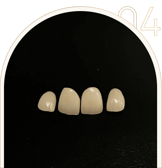 Gotowe licówki zębowe Gotowe licówki zębowe wykonane w Tychach