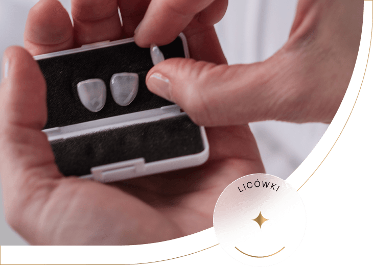 Wstawianie licówek w Tychach Usługi wstawiania licówek Tychy