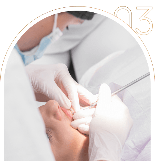 Zakładanie aparatu ortodontycznego Zakładanie aparatu ortodontycznego