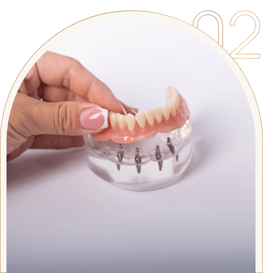 Wygodna proteza na implantach Wygodna proteza na implantach wykonana w Tychach