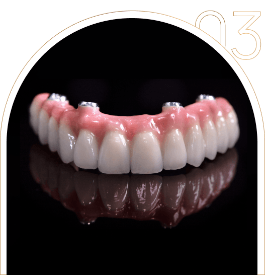 Estetyczna proteza na implantach Estetyczna proteza na implantach