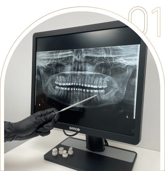 Wykonane RTG zębów Wykonane RTG zębów