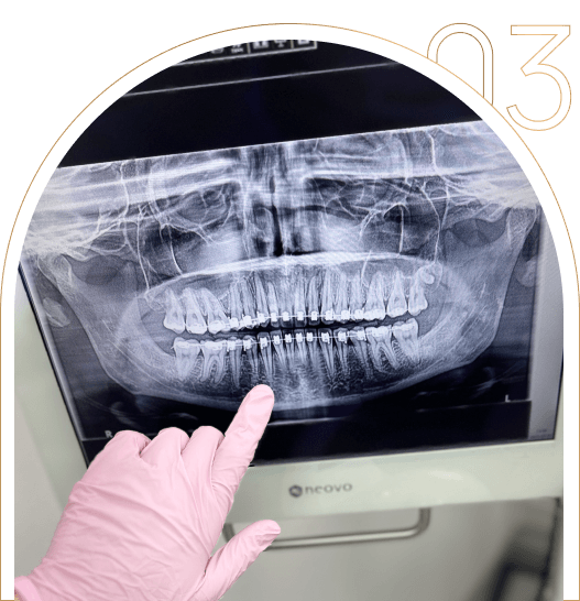 Prześwietlenie zębów RTG Prześwietlenie zębów RTG