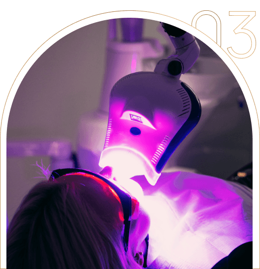 Gabinetowe wybielanie zębów w Tychach Gabinetowe wybielanie zębów w DentalLove