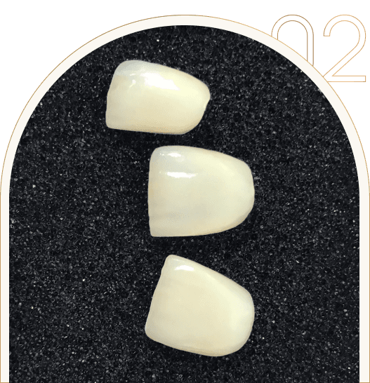 Stomatologia Estetyczna – licówki zębowe Stomatologia Estetyczna - licówki zębowe Tychy