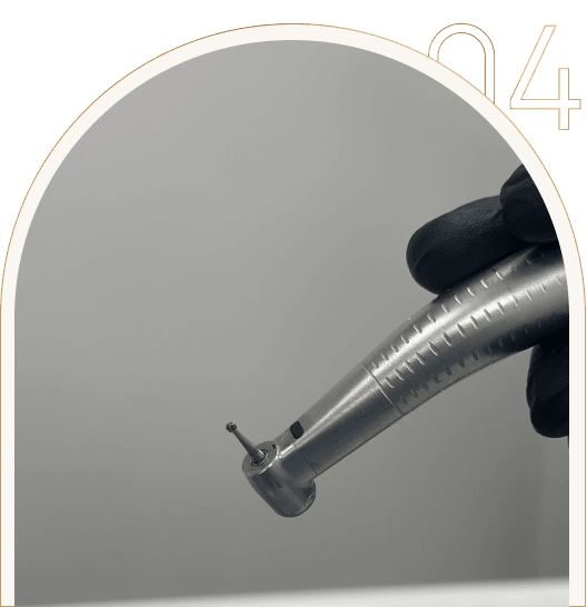 Stomatologia zachowawcza w Tychach Stomatologia zachowawcza w Tychach